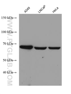 FATP2 Mouse Monoclonal Antibody, Proteintech Unconjugated; 150 &mu;L:Antibodies,