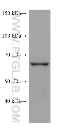 FATP2 Mouse Monoclonal Antibody, Proteintech Unconjugated; 150 &mu;L:Antibodies,