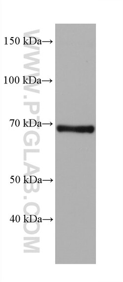 FATP2 Mouse Monoclonal Antibody, Proteintech Unconjugated; 150 &mu;L:Antibodies,