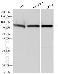 FATS Rabbit Polyclonal Antibody, Proteintech:Antibodies:Primary Antibodies