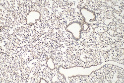 Fibulin 5 Rabbit Polyclonal Antibody, Proteintech Unconjugated; 150 &mu;L:Antibodies,
