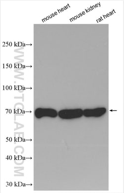 Fibulin 5 Rabbit Polyclonal Antibody, Proteintech Unconjugated; 150 &mu;L:Antibodies,
