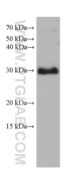 FBXO17 Mouse Monoclonal Antibody, Proteintech Unconjugated; 150 &mu;L:Antibodies,