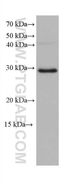FBXO17 Mouse Monoclonal Antibody, Proteintech Unconjugated; 150 &mu;L:Antibodies,