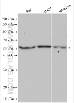 FCGR3B/CD16b Rabbit Polyclonal Antibody, Proteintech:Antibodies:Primary