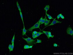 FER Mouse Monoclonal Antibody, Proteintech:Antibodies:Primary Antibodies