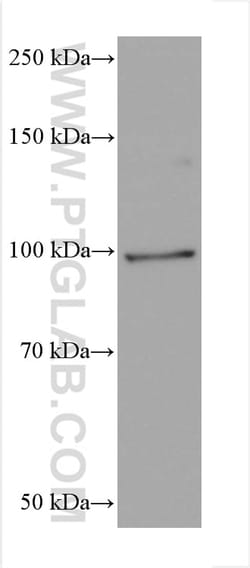 FER Mouse Monoclonal Antibody, Proteintech:Antibodies:Primary Antibodies
