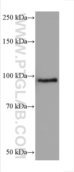 FER Mouse Monoclonal Antibody, Proteintech:Antibodies:Primary Antibodies