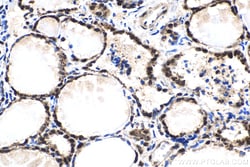 FGF-2 Rabbit Polyclonal Antibody, Proteintech Unconjugated; 20 &mu;L:Antibodies,