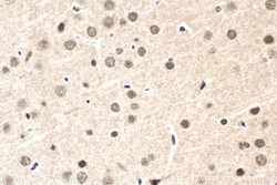 FGF-2 Rabbit Polyclonal Antibody, Proteintech Unconjugated; 20 &mu;L:Antibodies,