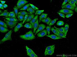 CoraLite Plus 488-conjugated FGFR3 Mouse Monoclonal Antibody, Proteintech
