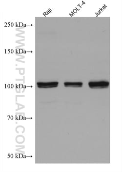 FGFR4 Mouse Monoclonal Antibody, Proteintech Unconjugated; 20 &mu;L:Antibodies,