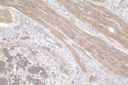 FH Mouse Monoclonal Antibody, Proteintech Unconjugated; 150 &mu;L:Antibodies,