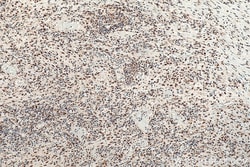 FKBP5 Mouse Monoclonal Antibody, Proteintech 150 &mu;L | Buy Online | Proteintech | Fisher Scientific
