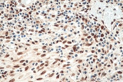 FKBP5 Mouse Monoclonal Antibody, Proteintech 150 &mu;L | Buy Online | Proteintech | Fisher Scientific