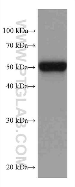 FKBP5 Mouse Monoclonal Antibody, Proteintech 150 &mu;L | Buy Online | Proteintech | Fisher Scientific