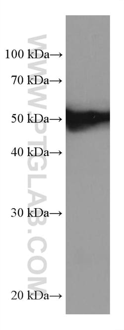 FKBP5 Mouse Monoclonal Antibody, Proteintech 150 &mu;L | Buy Online | Proteintech | Fisher Scientific