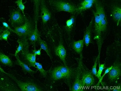 FMNL3 Rabbit Polyclonal Antibody, Proteintech:Antibodies:Primary Antibodies