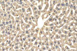 FMNL3 Rabbit Polyclonal Antibody, Proteintech:Antibodies:Primary Antibodies