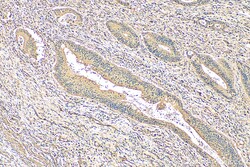 FMNL3 Rabbit Polyclonal Antibody, Proteintech:Antibodies:Primary Antibodies