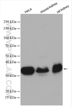 FOLR1 Rabbit Polyclonal Antibody, Proteintech