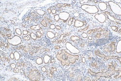 FOXE1 Rabbit Polyclonal Antibody, Proteintech