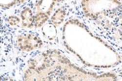 FOXE1 Rabbit Polyclonal Antibody, Proteintech:Antistoffer:Primære antistoffer