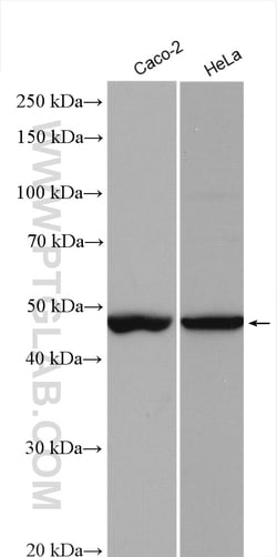 FOXJ1 Rabbit Polyclonal Antibody, Proteintech Unconjugated; 20 &mu;L:Antibodies,