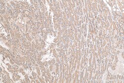 FTO Rabbit Recombinant Antibody, Proteintech Unconjugated; 100 &mu;L:Antibodies