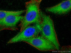 FUCA2 Rabbit Polyclonal Antibody, Proteintech:Antibodies:Primary Antibodies