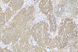 FUCA2 Rabbit Polyclonal Antibody, Proteintech:Antibodies:Primary Antibodies