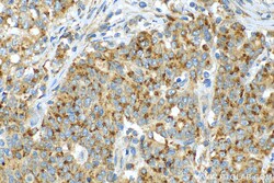 FUCA2 Rabbit Polyclonal Antibody, Proteintech:Antibodies:Primary Antibodies