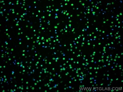 FUS/TLS Mouse Monoclonal Antibody, Proteintech Unconjugated; 20 &mu;L:Antibodies,