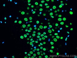 FUS/TLS Mouse Monoclonal Antibody, Proteintech Unconjugated; 20 &mu;L:Antibodies,