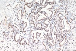 FUS/TLS Mouse Monoclonal Antibody, Proteintech Unconjugated; 20 &mu;L:Antibodies,