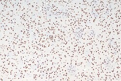 FUS/TLS Mouse Monoclonal Antibody, Proteintech Unconjugated; 20 &mu;L:Antibodies,