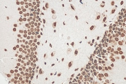 FUS/TLS Mouse Monoclonal Antibody, Proteintech Unconjugated; 20 &mu;L:Antibodies,