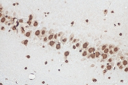 FUS/TLS Mouse Monoclonal Antibody, Proteintech Unconjugated; 20 &mu;L:Antibodies,