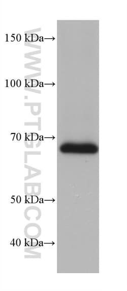 FUS/TLS Mouse Monoclonal Antibody, Proteintech Unconjugated; 20 &mu;L:Antibodies,