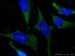 FXR1 Mouse Monoclonal Antibody, Proteintech Unconjugated; 20 &mu;L:Antibodies,