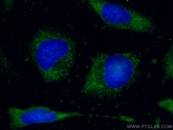 FXR1 Mouse Monoclonal Antibody, Proteintech Unconjugated; 20 &mu;L:Antibodies,