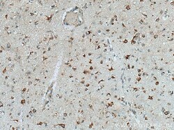 FXR1 Mouse Monoclonal Antibody, Proteintech Unconjugated; 20 &mu;L:Antibodies,