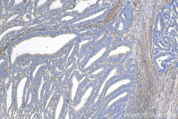 Fibrillin 1 Rabbit Polyclonal Antibody, Proteintech Unconjugated; 150 &mu;L:Antibodies,