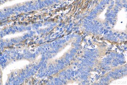 Fibrillin 1 Rabbit Polyclonal Antibody, Proteintech Unconjugated; 150 &mu;L:Antibodies,