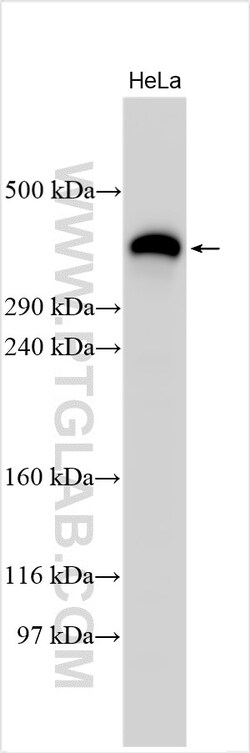 Fibrillin 1 Rabbit Polyclonal Antibody, Proteintech Unconjugated; 150 &mu;L:Antibodies,