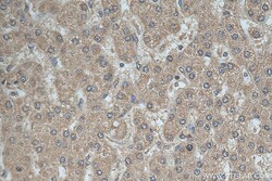 GALNT10 Rabbit Polyclonal Antibody, Proteintech:Antibodies:Primary Antibodies