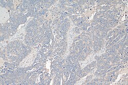 GALNT10 Rabbit Polyclonal Antibody, Proteintech:Antibodies:Primary Antibodies
