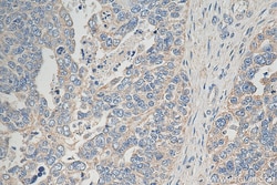 GALNT10 Rabbit Polyclonal Antibody, Proteintech:Antibodies:Primary Antibodies
