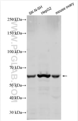 GALNT10 Rabbit Polyclonal Antibody, Proteintech:Antibodies:Primary Antibodies