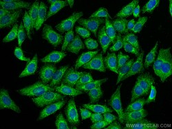 GALR2 Rabbit Polyclonal Antibody, Proteintech:Antibodies:Primary Antibodies